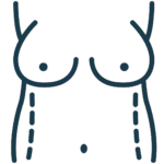 Lipoescultura